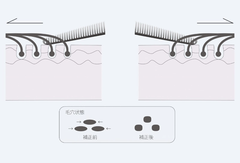 毛根補正効果のイラスト